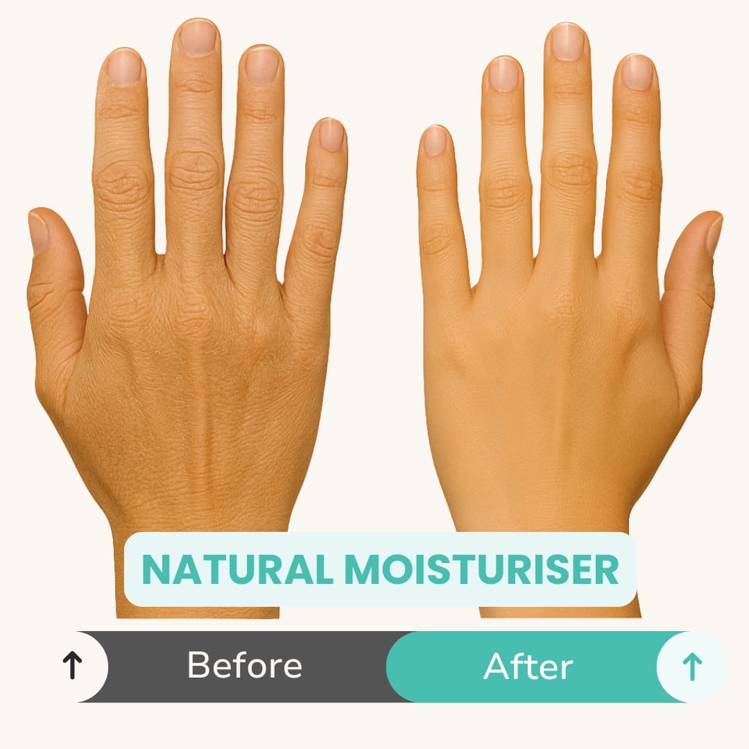Illustration of hands showing the effect of a natural moisturizer with 'Before' and 'After' labels.