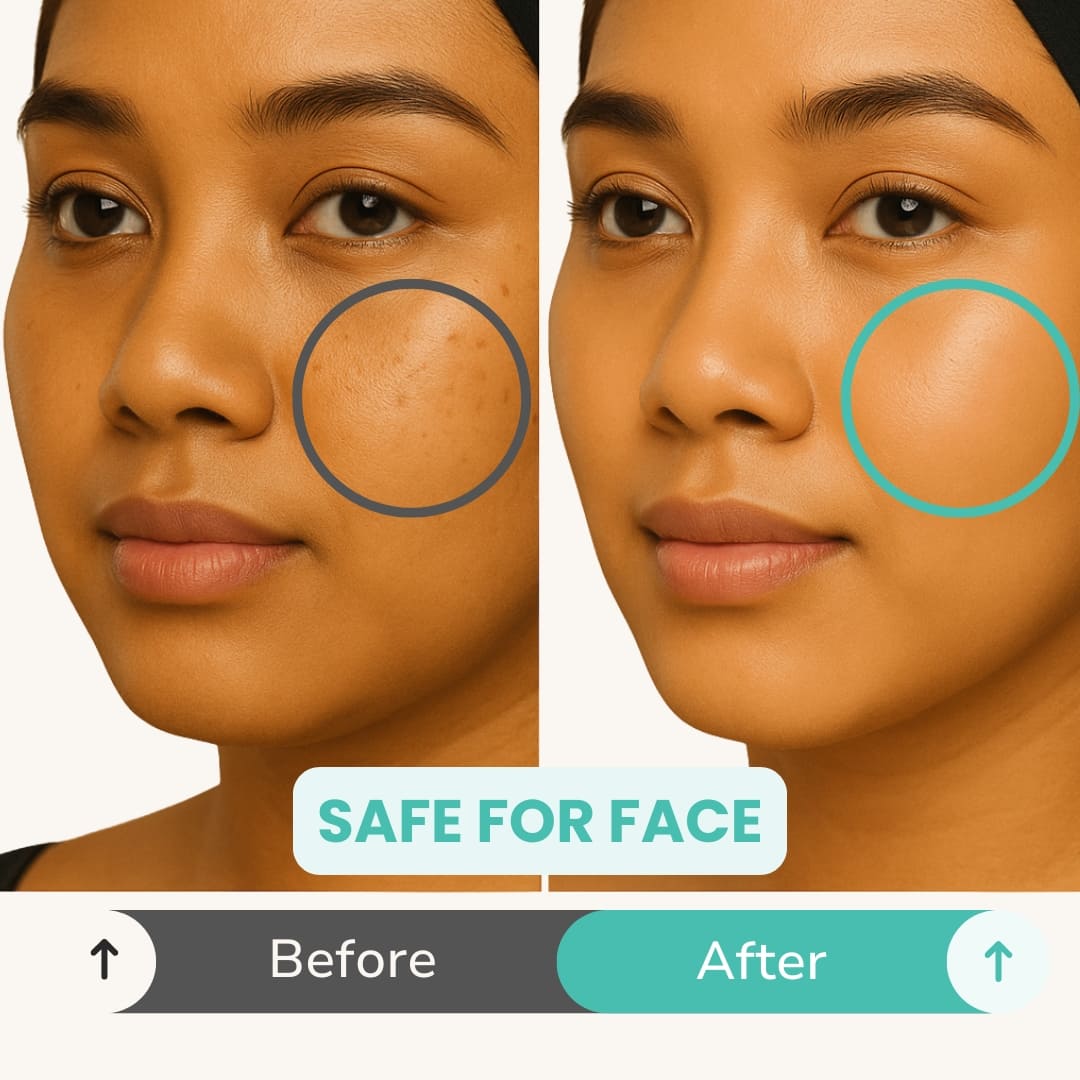 Before and after comparison of a skincare product on a person's face with 'Safe for Face' label.